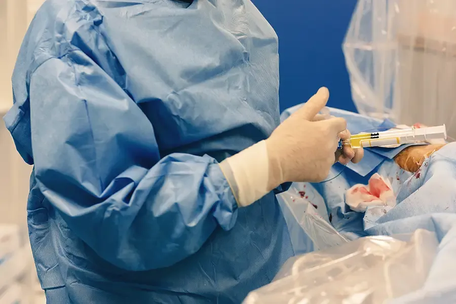 Medical illustration of uterine fibroids showing non-surgical treatment approach