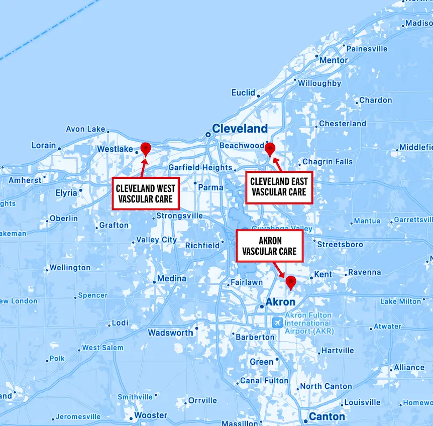 Map of Preferred Vascular Group locations across the Cleveland and Akron, Ohio area